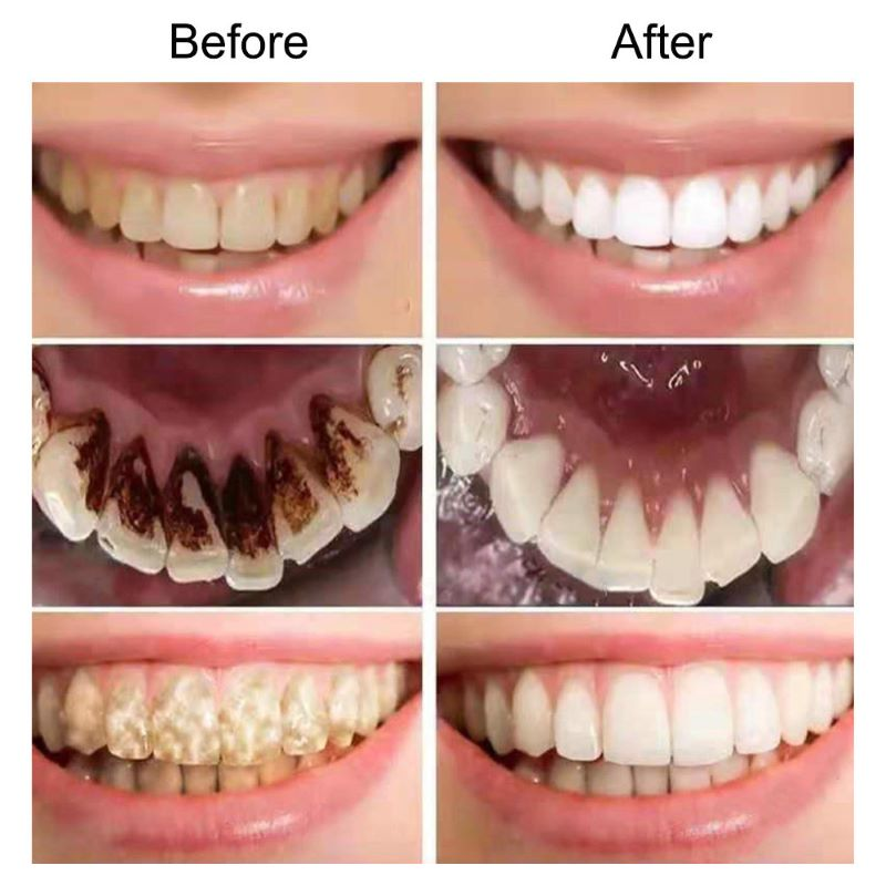Premium Purple Toothpaste Foam